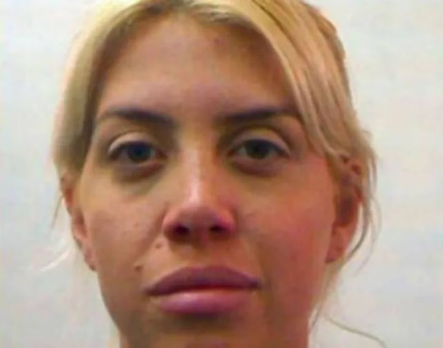Wanda Nara considera un nuevo retoque estético: ¿se quitará sus lunares?